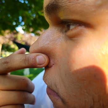 Medical Park Hastanesi Burnumu Mahveden Burun Ameliyatı