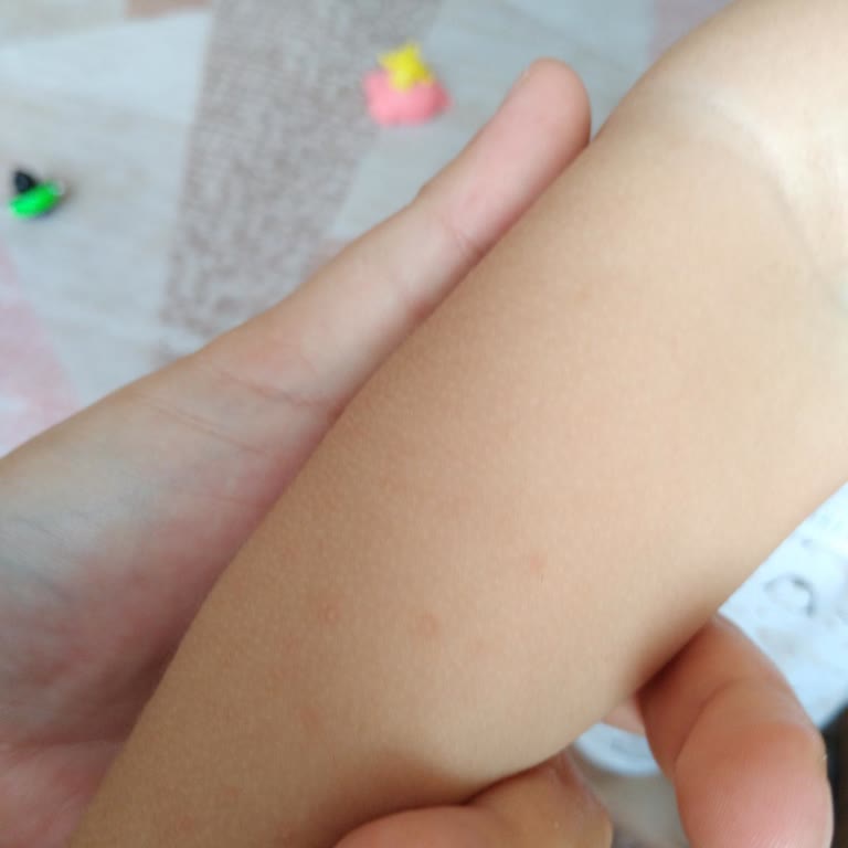 Watsons'tan Aldığım Cire Aseptine Güneş Kremi Alerji Yaptı