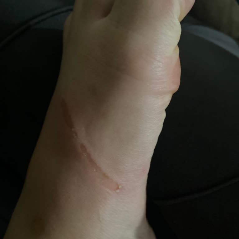 Pelinin Ayakkabıları Ayakları Yara Yaptı Ve Ücret İadem Yatırılmadı!