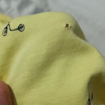 Profilo Çamaşır Yırtma Sorunu