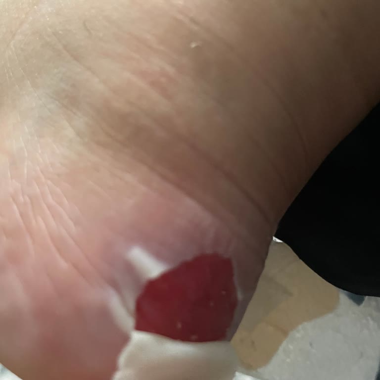 In Street Mağazasında Ayakkabı Değişim Sorunu