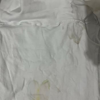 Stradivarius Defolu Ürünler Ve Kargo Parası İadesi