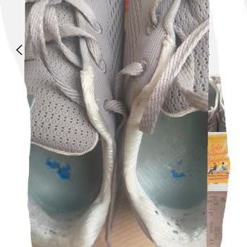 Skechers Ayakkabılarım İçin Çözüm İstiyorum