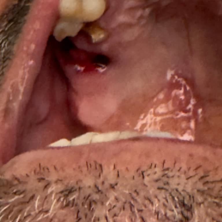 Dişhane Sağlık Grubu Kırık Diş Yerine Sağlam Diş Çekildi