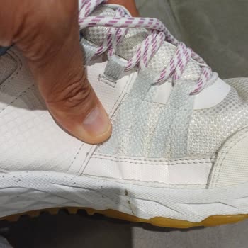 Skechers Ayakkabıda Kalite Sorunu Ve İade Talebi