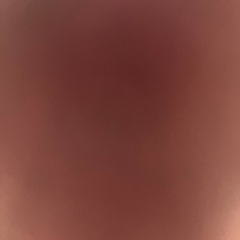 Atlas Hastanesi Kalesiz İşlem Yapıyor