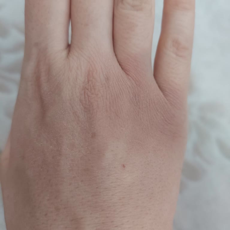 Denizli Özel Egekent Hastanesi Hemşirelerin İlgisiz Davranışı