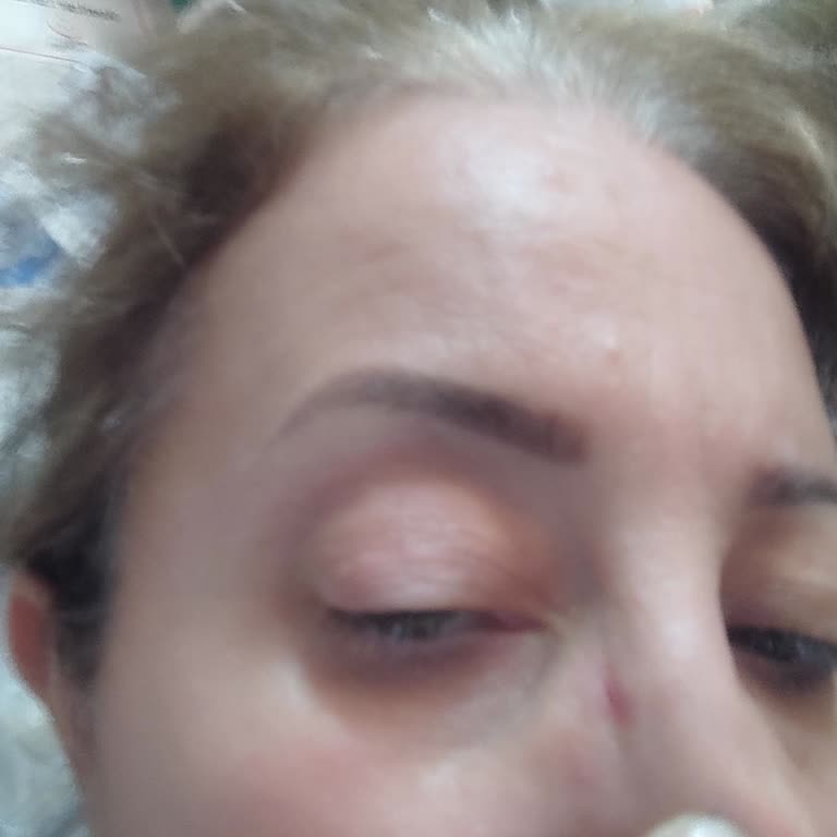 Atasun Optik Kalitesiz Hizmet Ve İlgisizlikten Dolayı Yaşadığım Mağduriyet