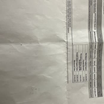 Schafer Üretim Hatası Ürün Satıp Sonra Tüketici Hatası Deniliyor