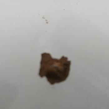 Vestel Servisten Çektiklerim, Yine Bana Aynı Servisi Yönlendiriyorlar.