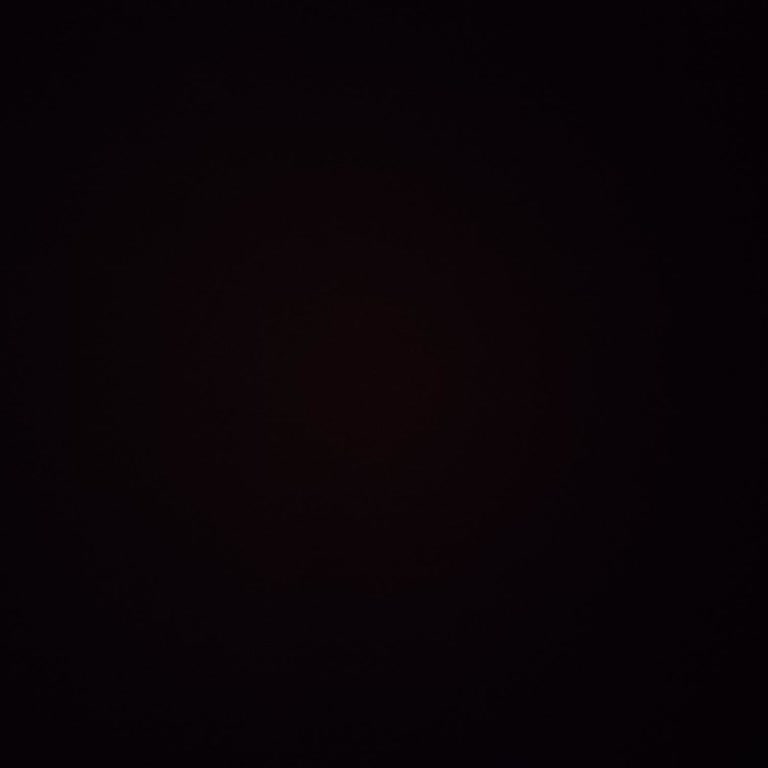 Esbalife Estetik & Bakım Merkezi Hizmet Vermeme Paketin İptali