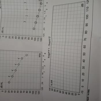 Duymer İşitme Cihazları Cihazı Tamamen Bir Fiyasko