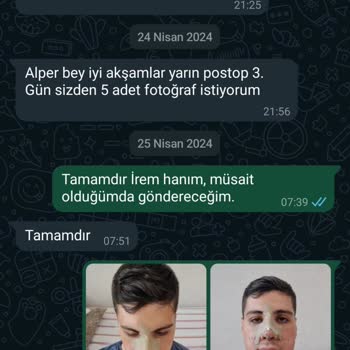 Op. Dr. Eda Çabuk Horoz Muayenehanesi Burun Estetiği Deneyimi Paylaşımı