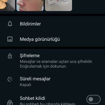 Op. Dr. Eda Çabuk Horoz Muayenehanesi Burun Estetiği Deneyimi Paylaşımı