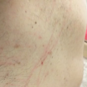 Devlet Hava Meydanları Antalya Uluslararasi Havalimanı Güvenlik Zaafiyeti