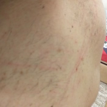 Devlet Hava Meydanları Antalya Uluslararasi Havalimanı Güvenlik Zaafiyeti