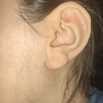 Nouvelle Vie Güzellik Merkezi Nouvelle Vie İzmit İstiklal Şubesi Pişmanlığı