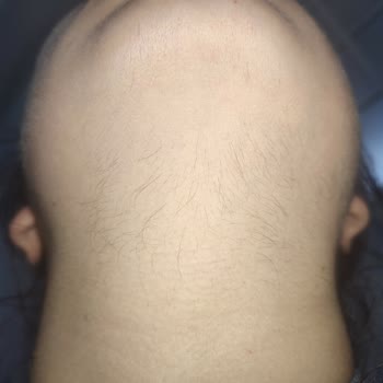 Nouvelle Vie Güzellik Merkezi Nouvelle Vie İzmit İstiklal Şubesi Pişmanlığı