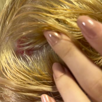 Palette 10.1 Boyası Saç Derimde Yanık Ve Kanamaya Sebep Oldu