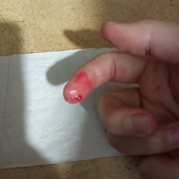 The Purest Solutions Aha+bha2 Serumdan Cam Çıktı