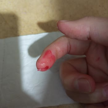 The Purest Solutions Aha+bha2 Serumdan Cam Çıktı