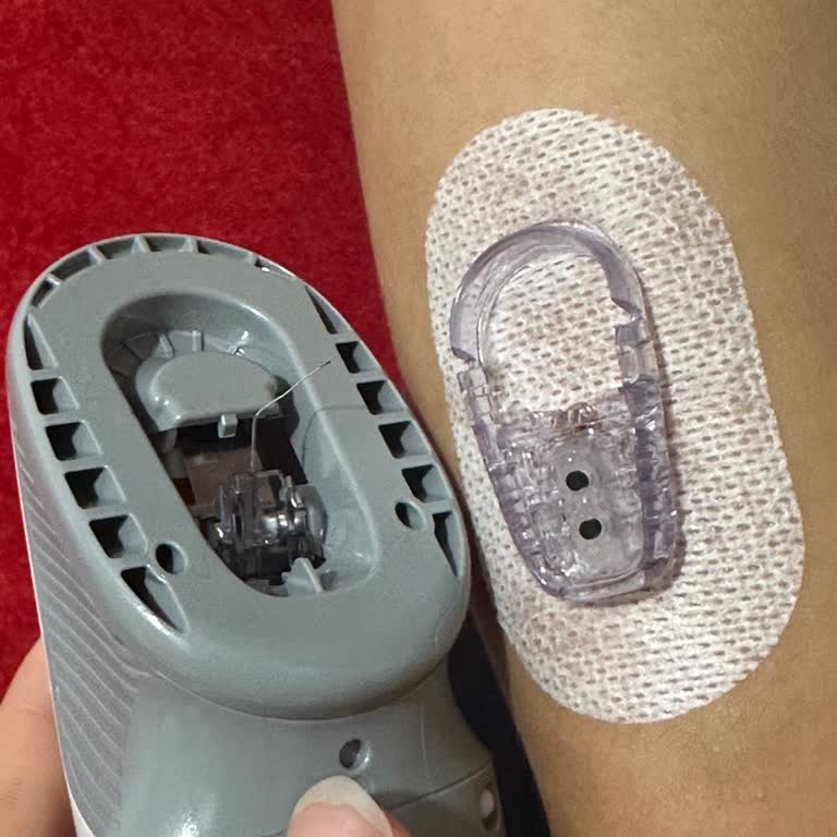 Dexcom G6 Cihaz Bozuk