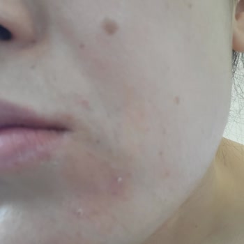 Trendyol Güneş Kremi Aldım Memnun Kalmadım