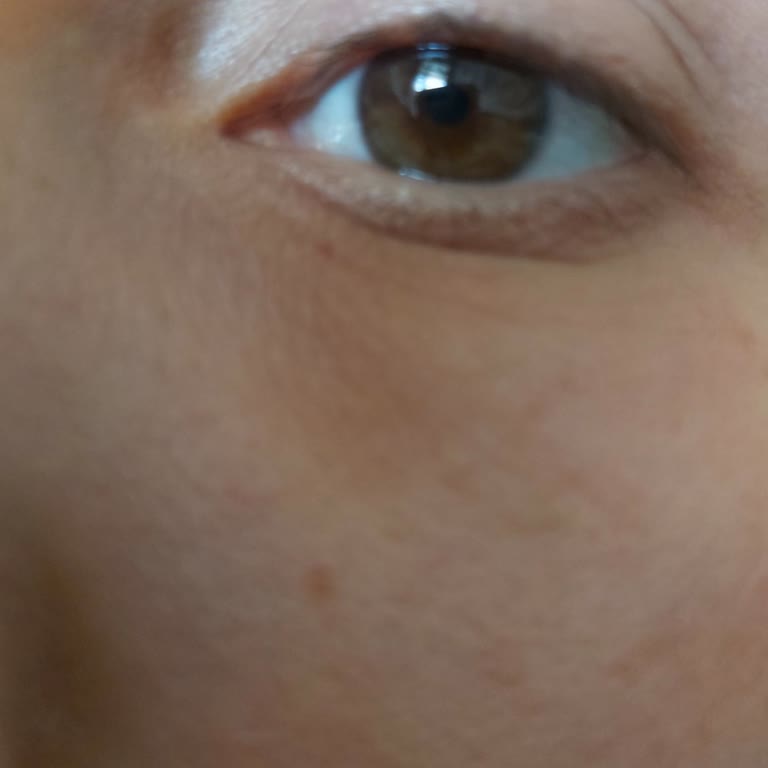 Maruderm Yüz Yıkama Jeli Cildime Zarar Verdi