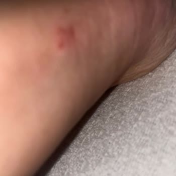 Ziya Mağazacılık Sandaletlerde Yaşanan Rahatsızlık Ve Müşteri Hizmetleri Sorunu