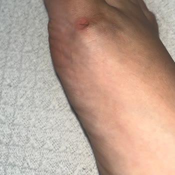 Ziya Mağazacılık Sandaletlerde Yaşanan Rahatsızlık Ve Müşteri Hizmetleri Sorunu