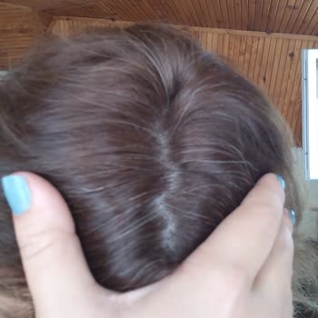 Loreal Excellence Beyaz Kapatmıyor Ve Rengi Küllü Olmuyor