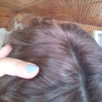 Loreal Excellence Beyaz Kapatmıyor Ve Rengi Küllü Olmuyor