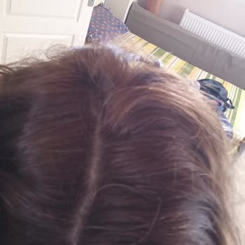 Loreal Excellence Beyaz Kapatmıyor Ve Rengi Küllü Olmuyor