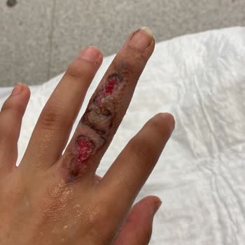 Yeliz Başaran Beauty Deki Bilinçsiz İşlem