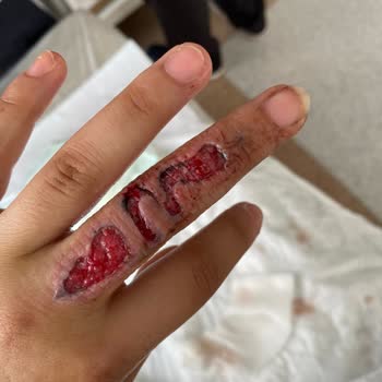 Yeliz Başaran Beauty Deki Bilinçsiz İşlem