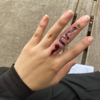 Yeliz Başaran Beauty Deki Bilinçsiz İşlem