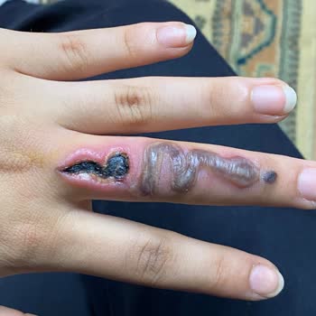 Yeliz Başaran Beauty Deki Bilinçsiz İşlem