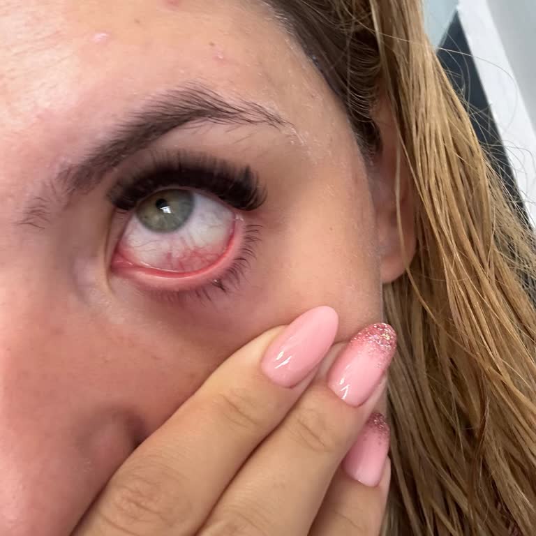 Sincan Başkent Kuaförde Yaptırmış Olduğum İpek Kirpiğin Kötülüğü