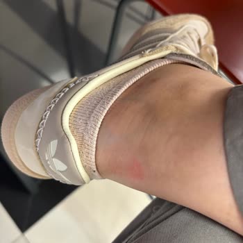 Adidas Samba Ayağa Vuruyor