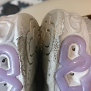 Skechers Çocuk Ayakkabısı Şikayeti