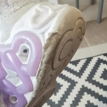 Skechers Çocuk Ayakkabısı Şikayeti