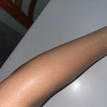 Bee Beauty Bee Beuty Marka Maske Yüzümü Yaktı