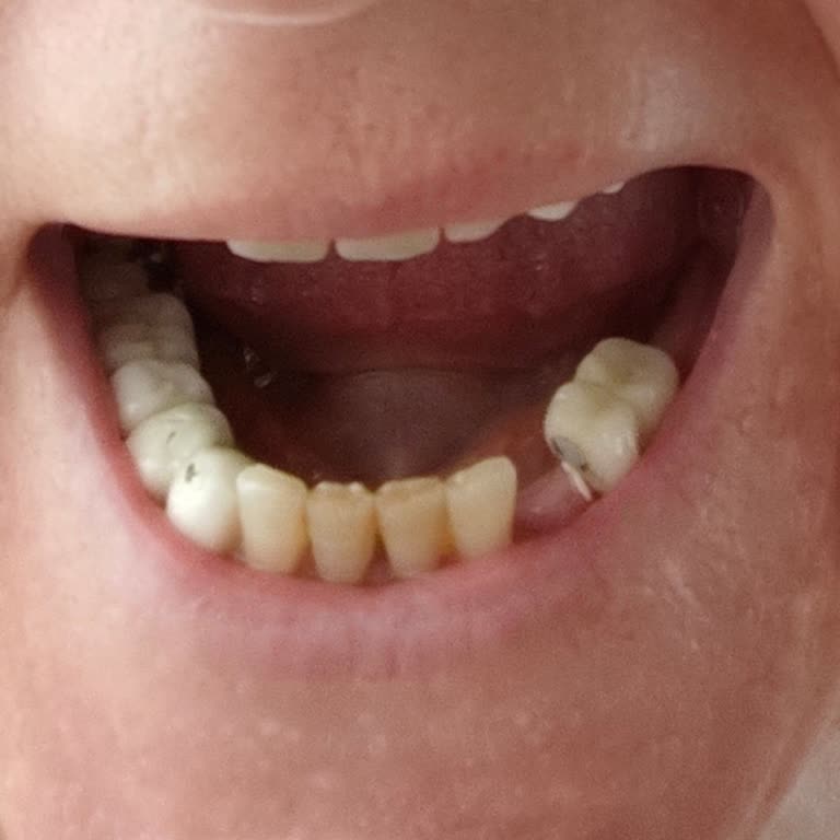 Çorlu Ağız ve Diş Sağlığı Merkezi Çorlu Ağız Ve Diş Sağlık Merkezi'nde Olumsuz Deneyim