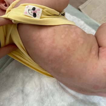 Mustela Şampuan Ve Kremleri