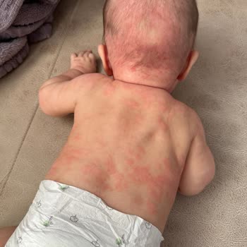 Mustela Şampuan Ve Kremleri