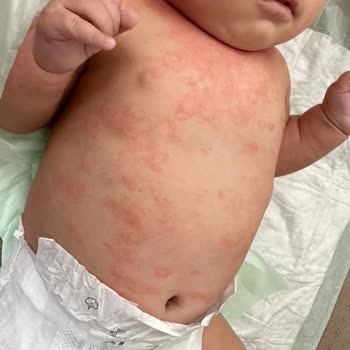 Mustela Şampuan Ve Kremleri