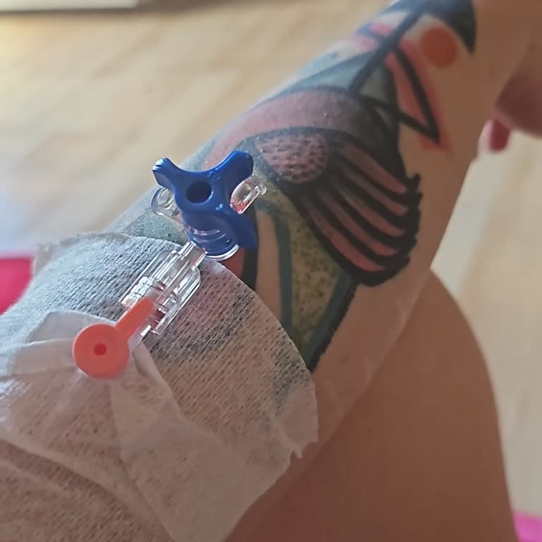 Herbalife Shake Ve Süt Tüketiminden Sonra Yaşanan Sağlık Sorunları