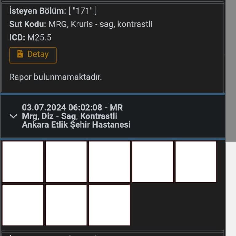 Ankara Etlik Şehir Hastanesi Benim MR Bir Aydan Fazla Oldu Raporlanmadı