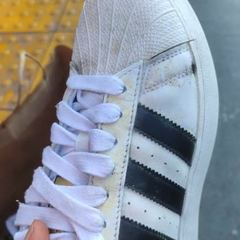 Adidas'a İncelemeye Gönderdiğim Ayakkabımın Küflü Pis Geri Gelmesi