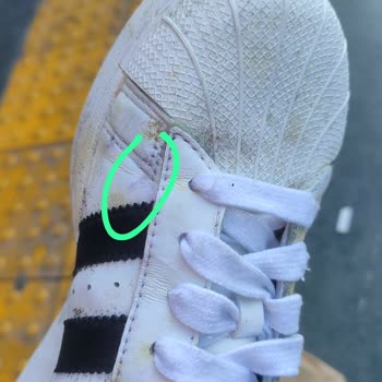 Adidas'a İncelemeye Gönderdiğim Ayakkabımın Küflü Pis Geri Gelmesi